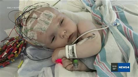 St. Louis baby diagnosed with rare brain tumor survives after surgery